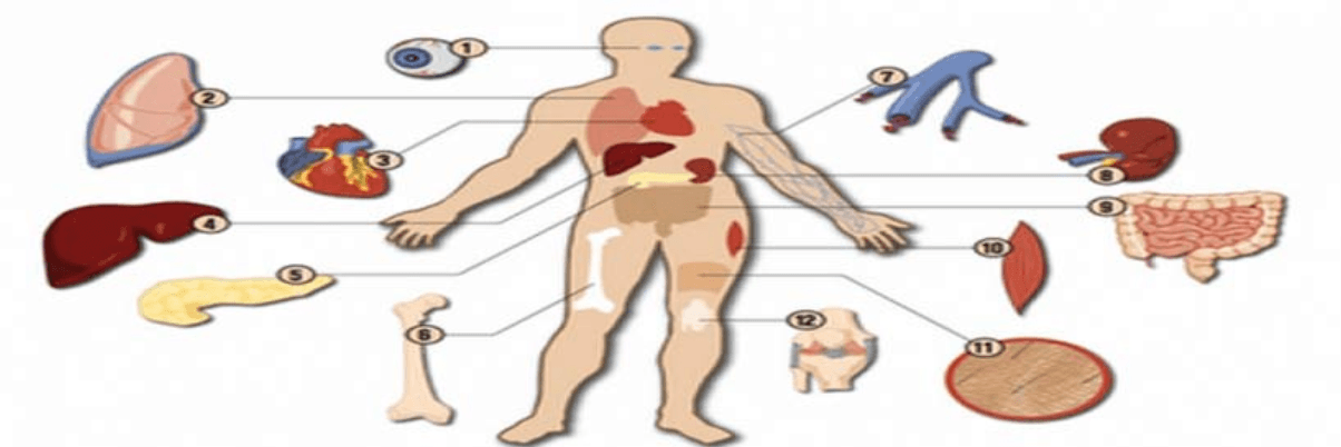 Sale of Human Organs – Study IV