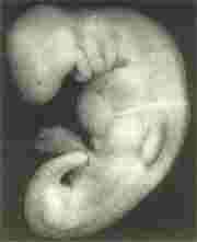 Embryo12.jpg