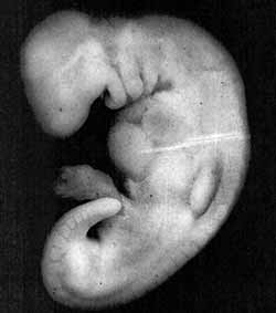 Embryo18.jpg